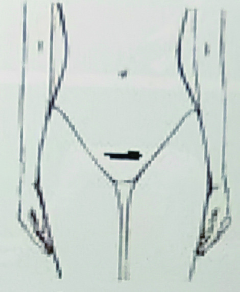 附 圖